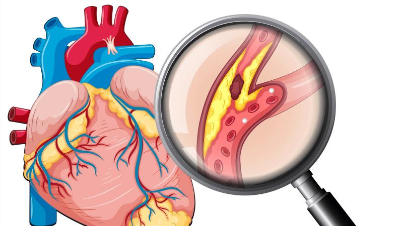 19-21 giờ: Thời gian giải độc màng ngoài tim