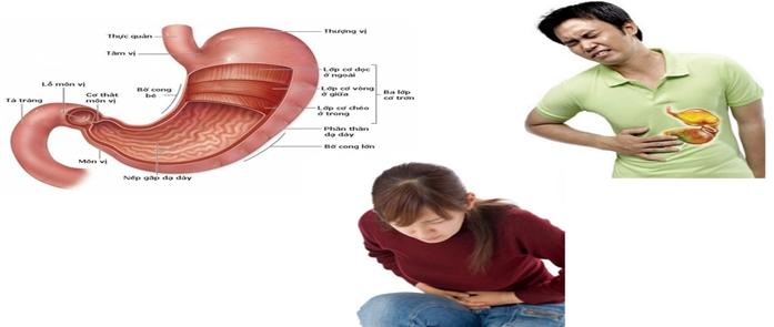 Bệnh đau dạ dày với những cơn đau dữ dội