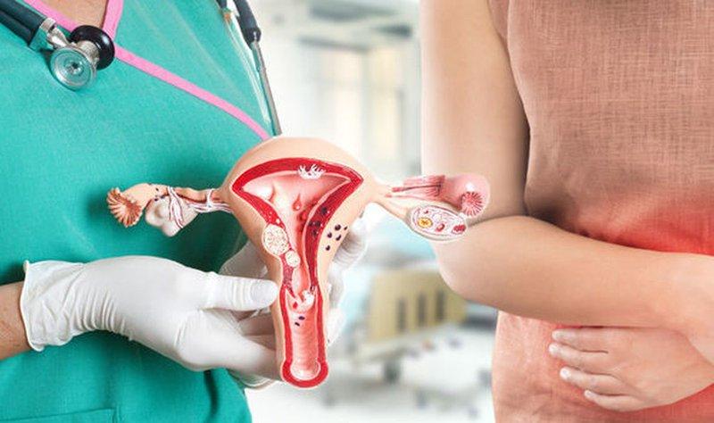 Ung thư cổ tử cung là oại ung thư thường gặp nhất do HPV gây ra