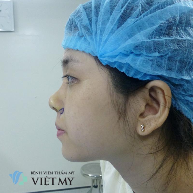 Bệnh viện thẩm mỹ Việt Mỹ