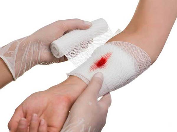 Bị thương là gì?