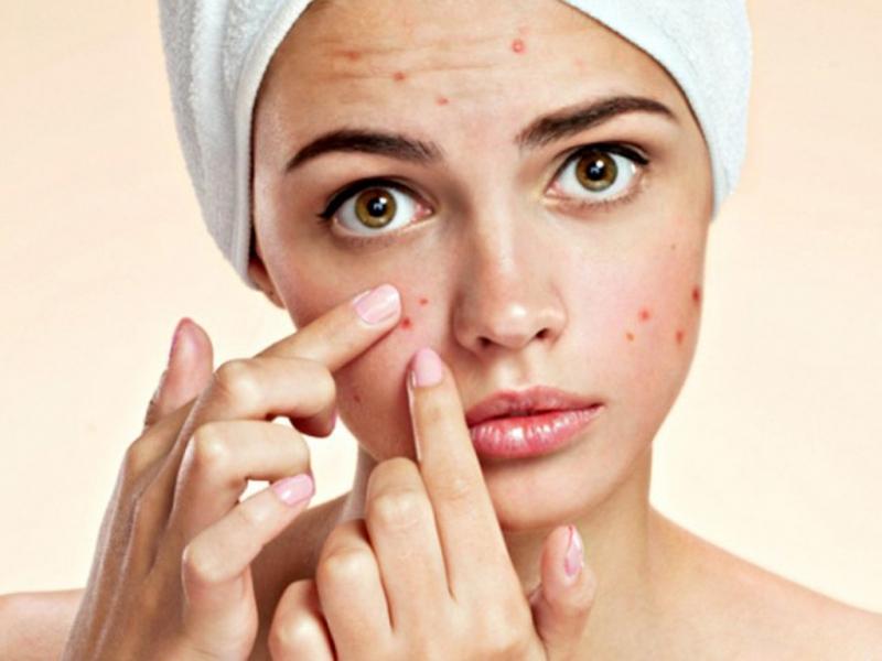 Rối loại về da có thể do cơ thể bị nhiễm độc hoặc bị stress