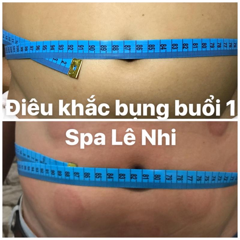 Điêu khắc bụng buổi 1 tại Spa Lê Nhi