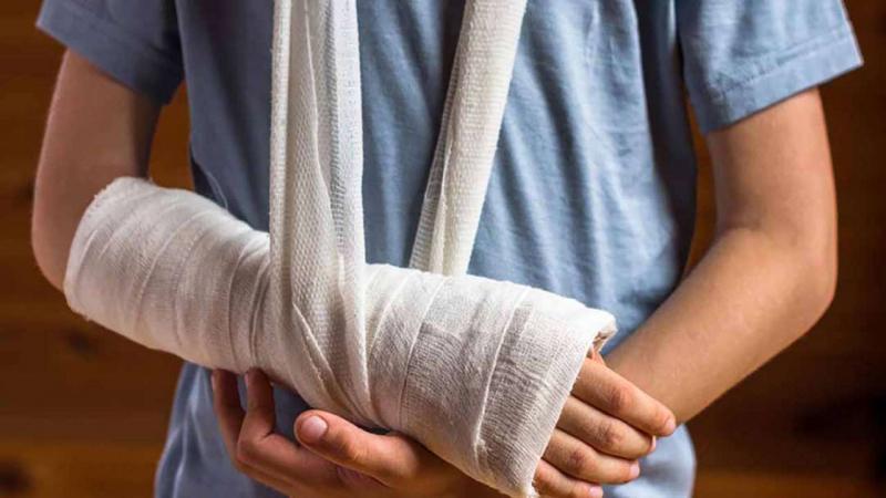 Xin lời khuyên từ bác sĩ nếu muốn đi báy bay khi bó bột