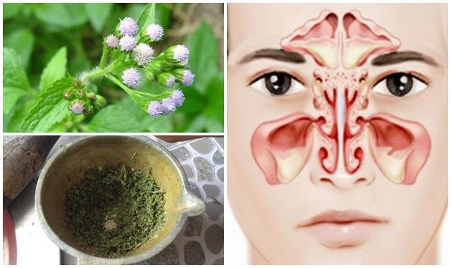 Cách chữa viêm xoang bằng hoa ngũ sắc