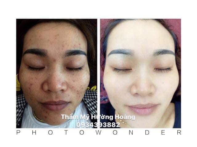 Hường Hoàng Spa
