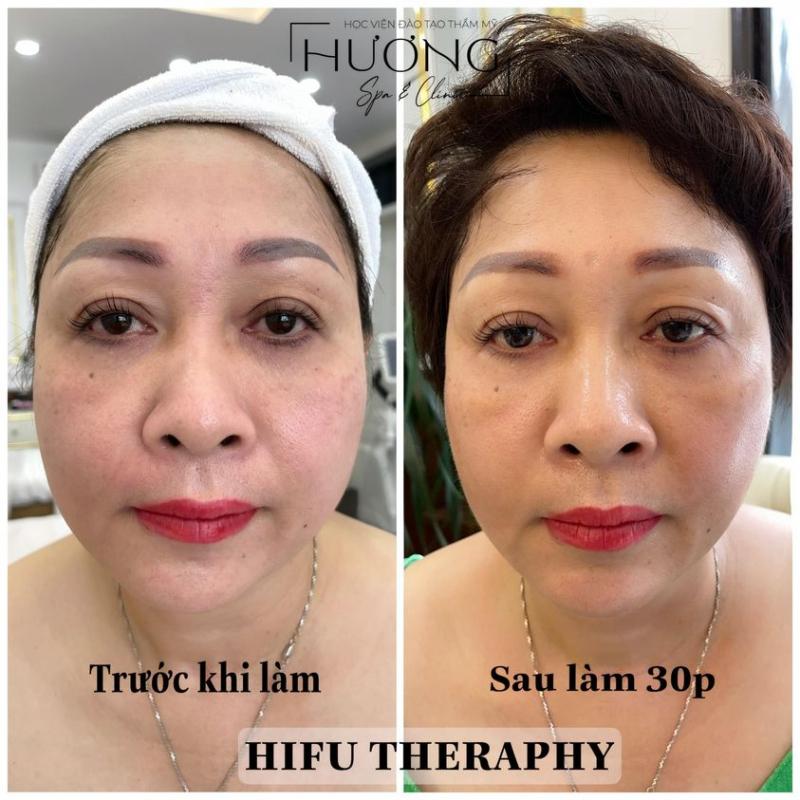 Hương Spa & Clinic