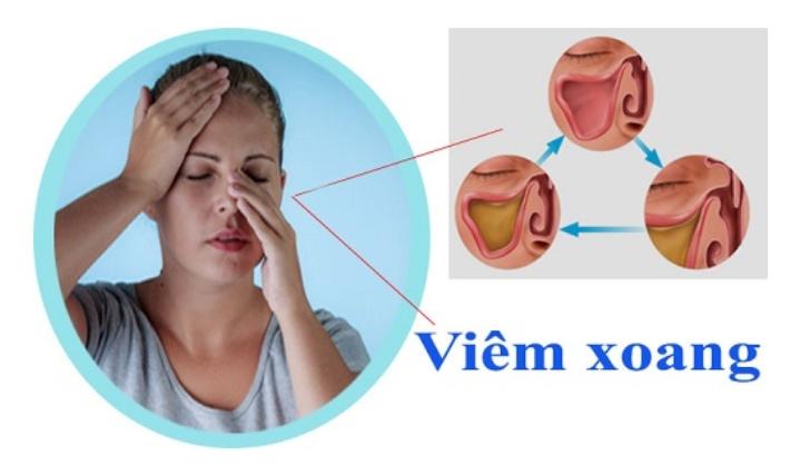 Trị viêm xoang bằng lá lốt mang lại hiệu quả cao
