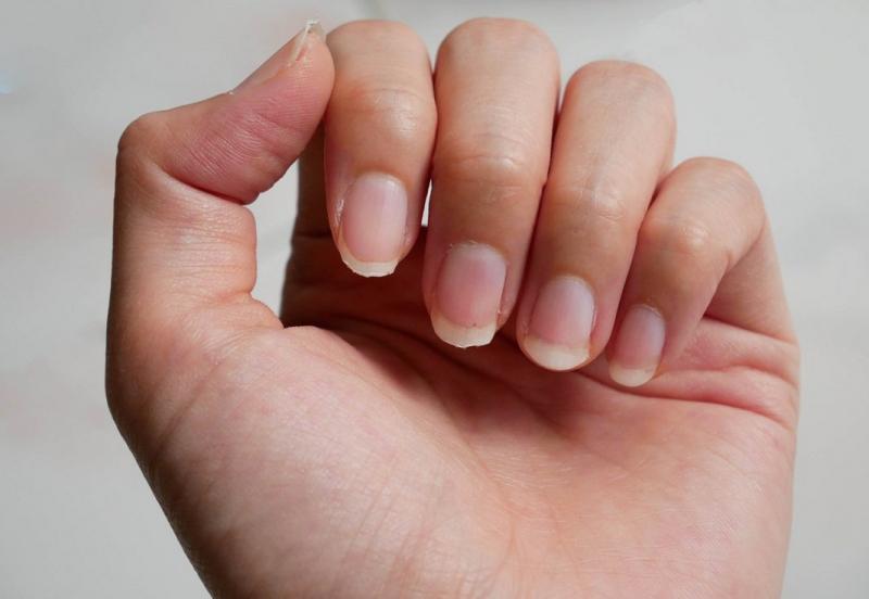 Móng tay và móng chân thực sự có thể cho bạn hiểu nhiều hơn về tình hình sức khỏe bản thân