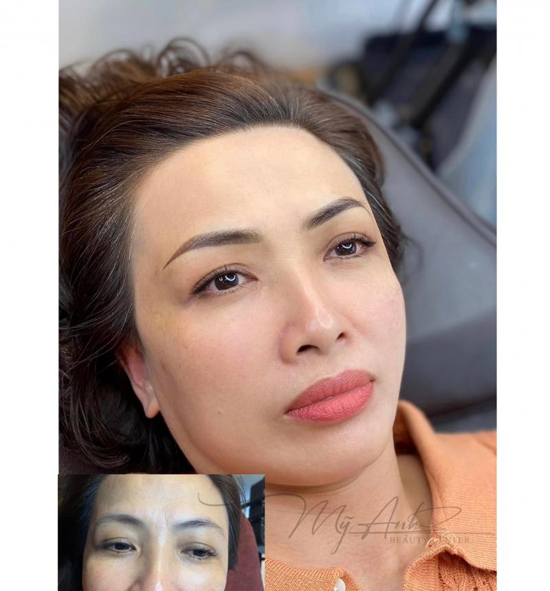 Mỹ Anh Beauty Center