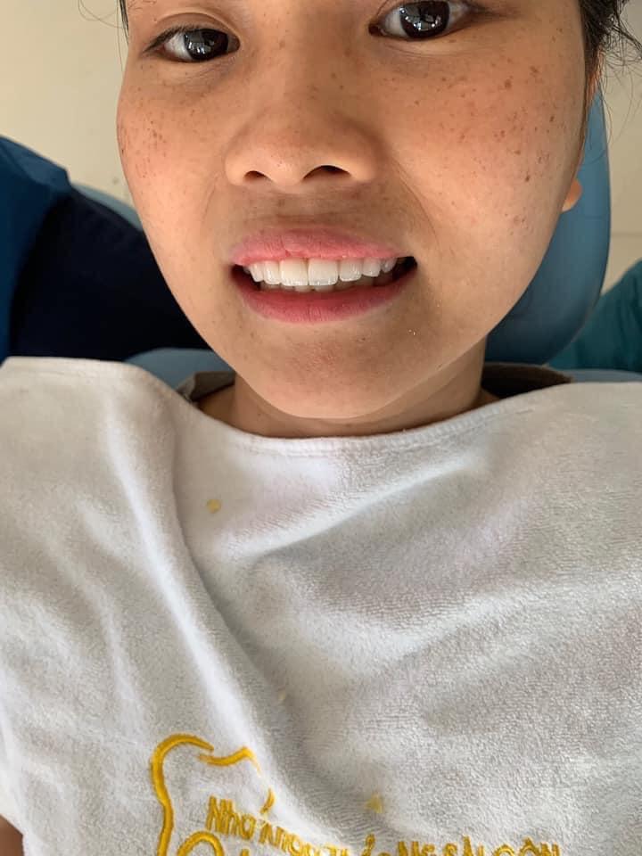 Nha Khoa Sài Gòn Duy Xuyên