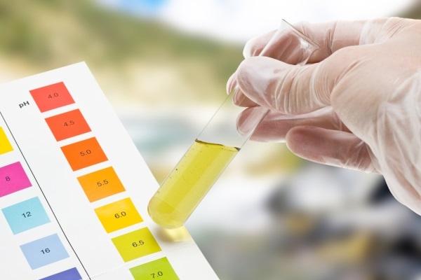 Nước tiểu màu vàng sẫm, dấu hiệu của bệnh thận