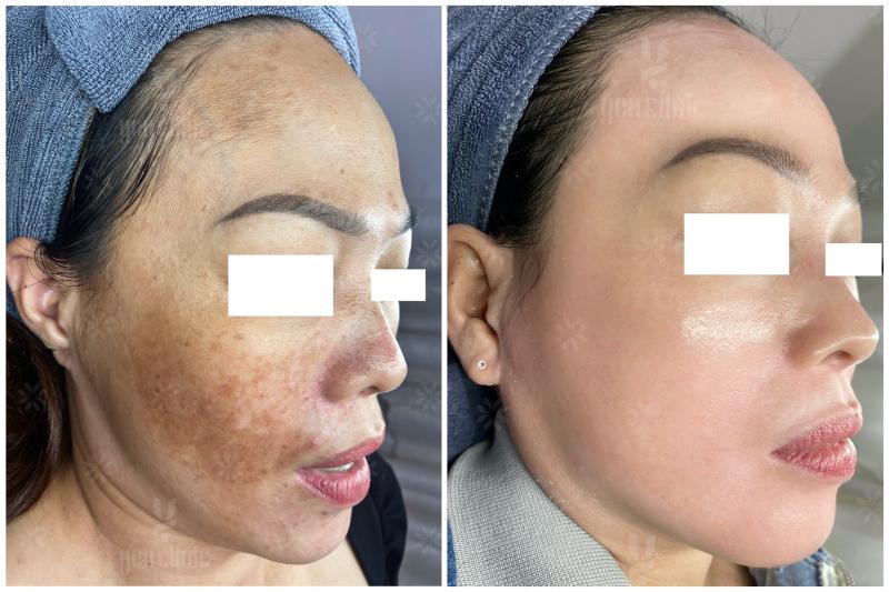 Phòng khám chuyên khoa Thẩm mỹ Yen Clinic