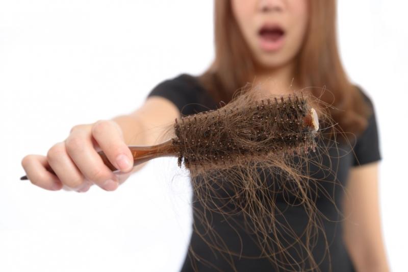 Rụng tóc do stress