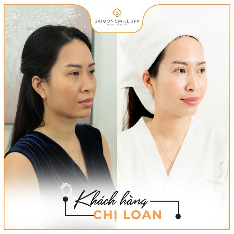 Saigon smile Spa