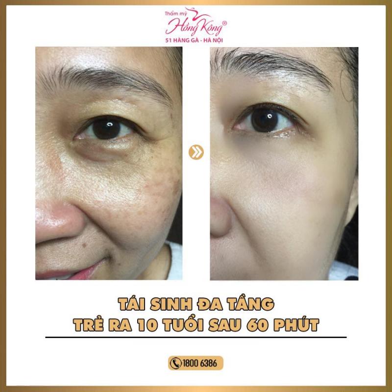 Thẩm mỹ Hồng Kông