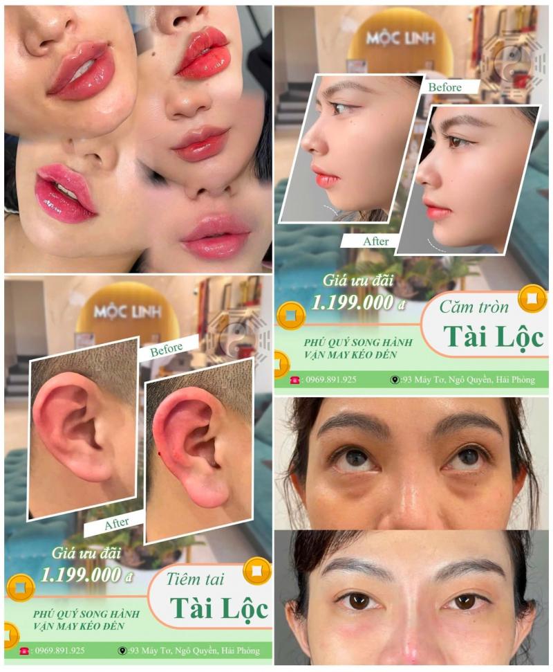 Thẩm Mỹ Mộc Linh