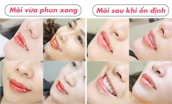 Thẩm mỹ Nguyệt Minh