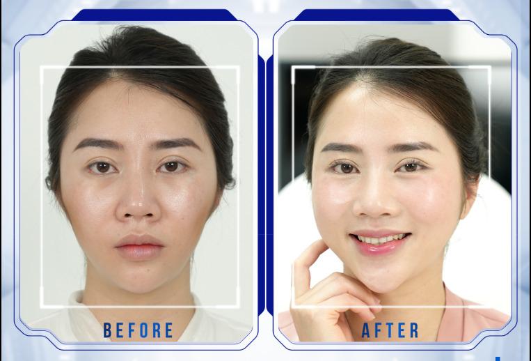 Thẩm mỹ quốc tế Bally