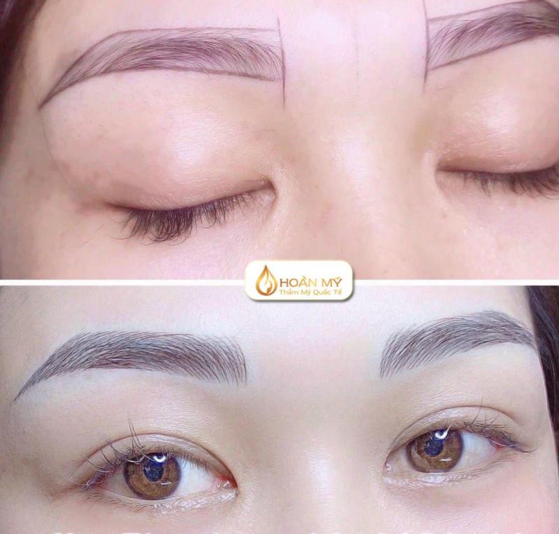 Thẩm Mỹ Quốc Tế Hoàn Mỹ