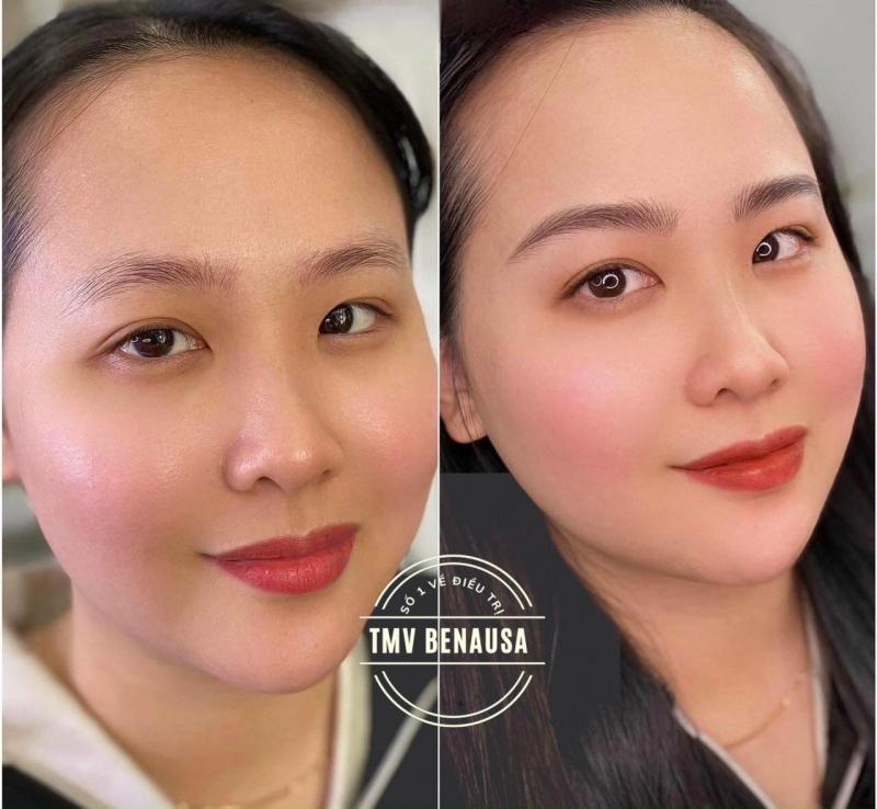 Thẩm Mỹ Viện Bena Usa