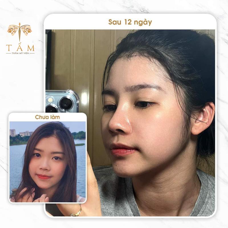 Thẩm mỹ viện Tấm
