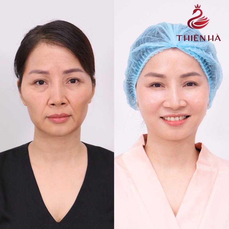 Thẩm mỹ viện Thiên Hà (Thiên Hà Spa)