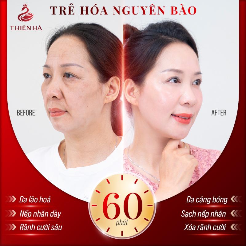 Thẩm mỹ viện Thiên Hà (Thiên Hà Spa)