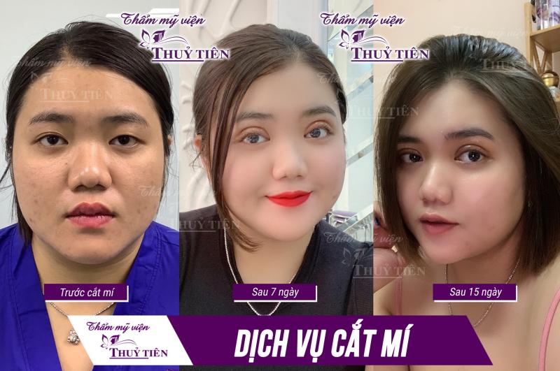 Thẩm mỹ viện Thủy Tiên