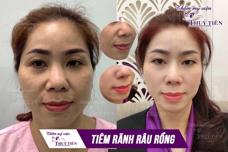 Thẩm mỹ viện Thủy Tiên