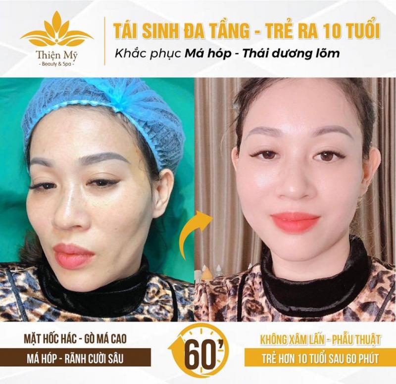 Thiện Mỹ Spa