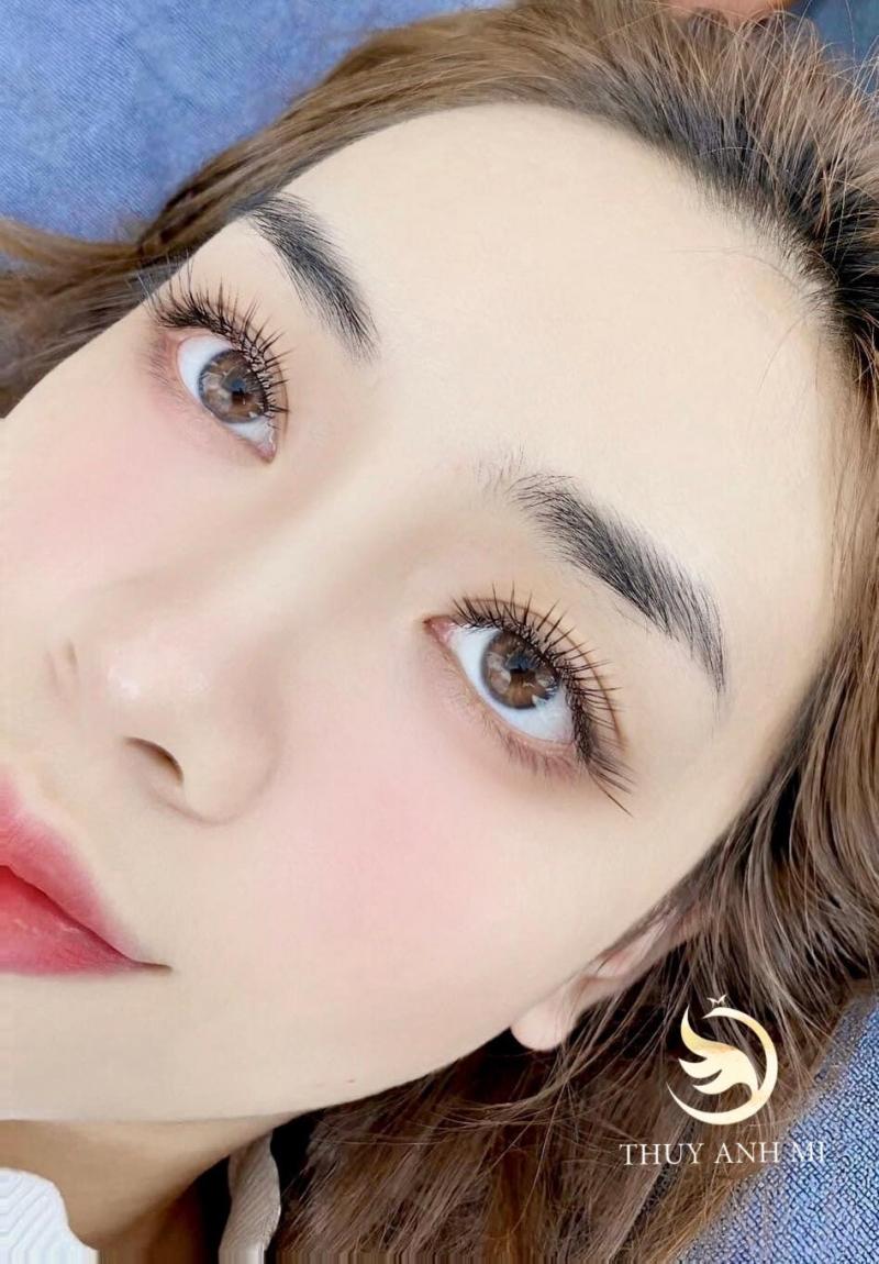 Thùy Anh Mi