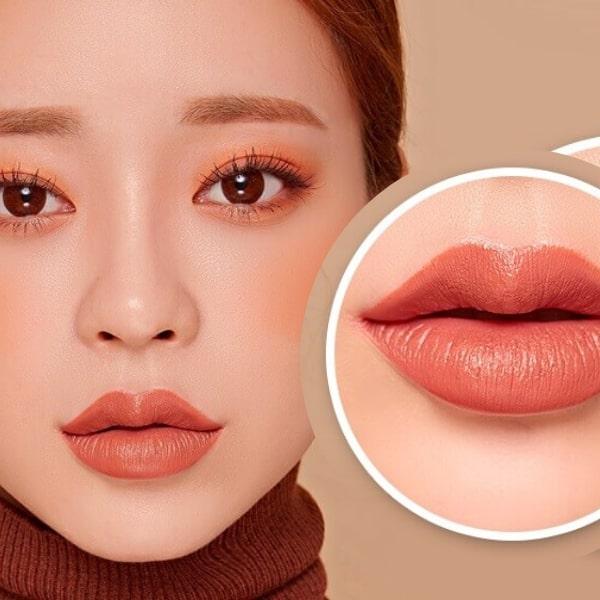 Trần Phi Yến Filler - botox