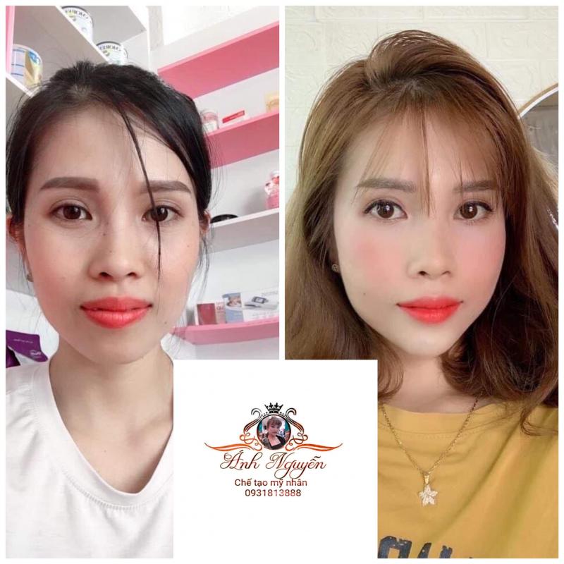 ﻿﻿Trung tâm thẩm mỹ Ánh Nguyễn