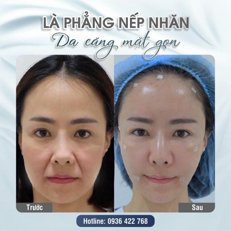 Viện thẩm mỹ công nghệ cao V-Medical