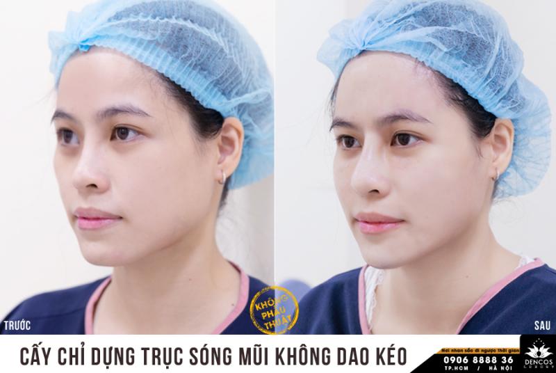Viện Thẩm Mỹ Quốc Tế Dencos Luxury