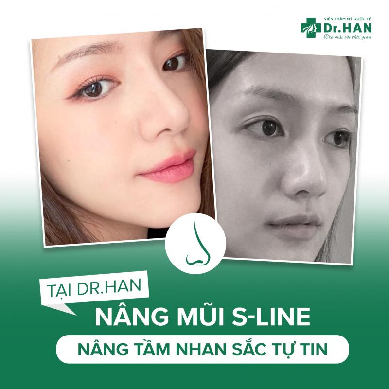 Thẩm mỹ Quốc tế Dr.Hana