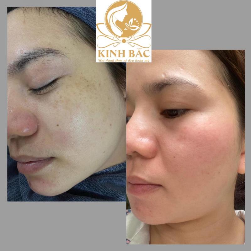 ﻿﻿Viện thẩm mỹ Quốc tế Kinh Bắc