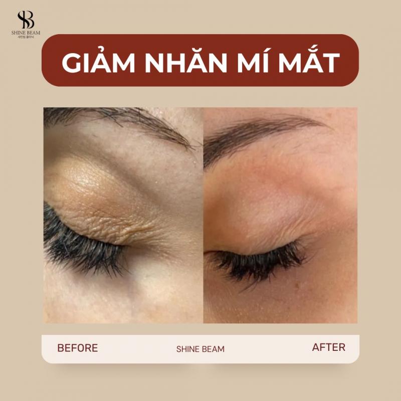 Viện thẩm mỹ Shine Beam Clinic