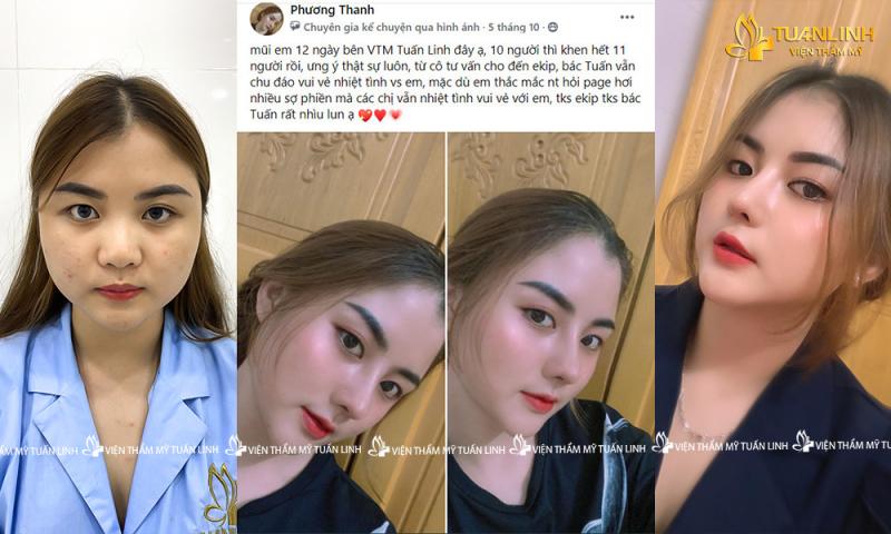 Viện Thẩm Mỹ Tuấn Linh
