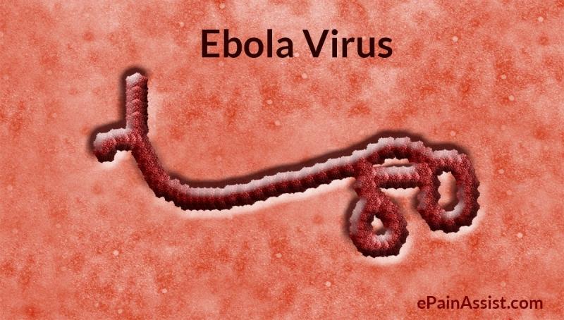 Virus Ebola